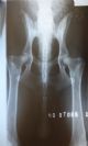 温斯顿 温斯顿